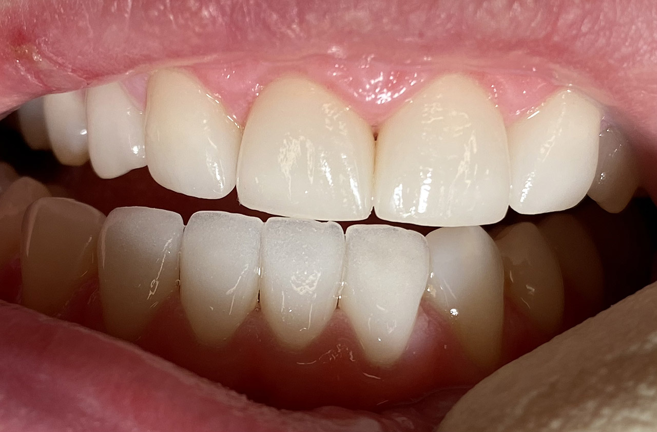 Ästhetische Zahnheilkunde / 01