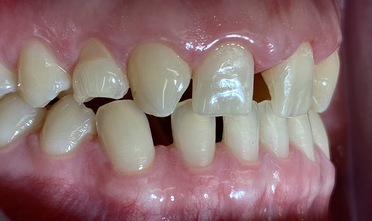 Ästhetische Zahnheilkunde / 04