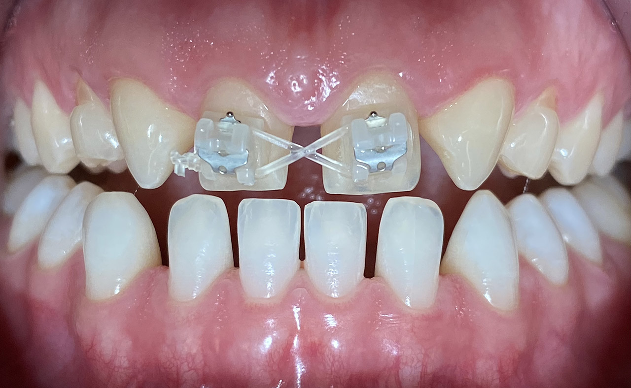 Ästhetische Zahnheilkunde / 06