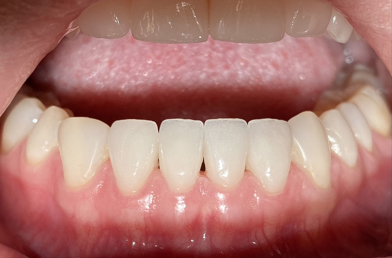 Ästhetische Zahnheilkunde / 14