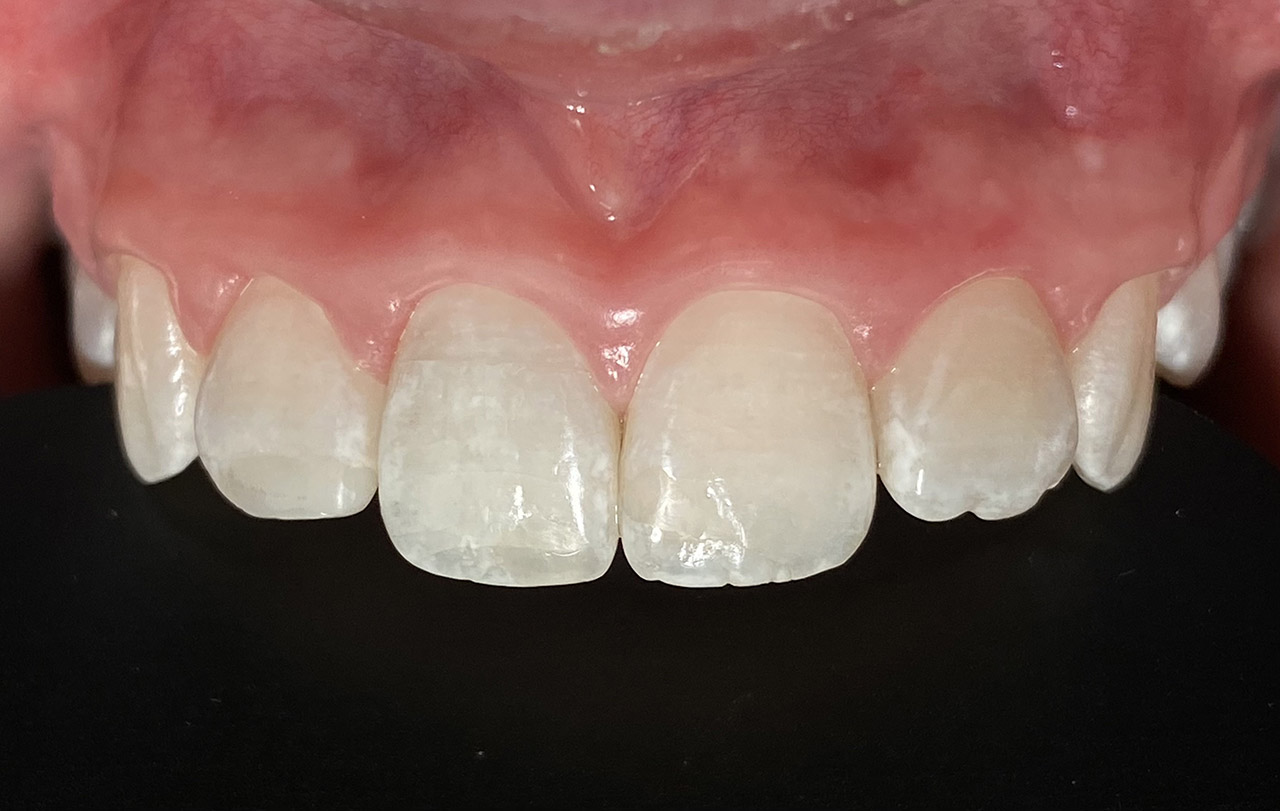 Traumatologie und Endodontie 10